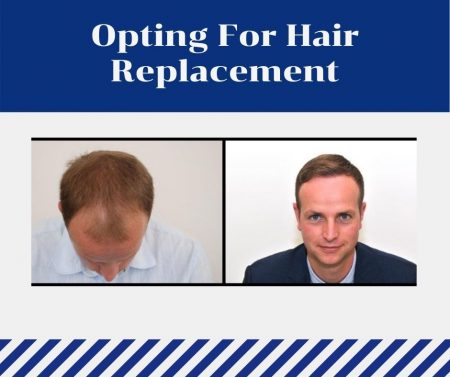 Opting-For-Hair-Replacement