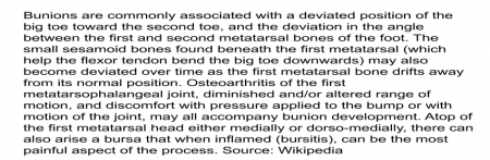 Bunions-are-a-deviated-position-of-the-big-toe-toward-the-second-toe