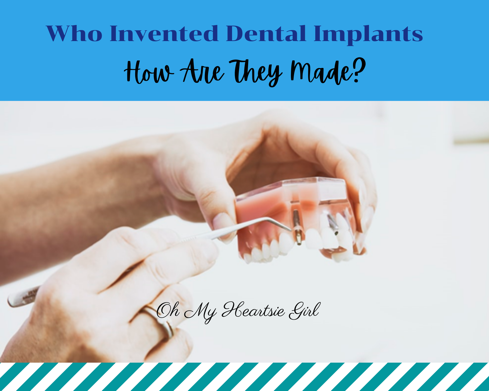 Who Invented Dental Implants & How Are They Made? - Oh My Heartsie Girl